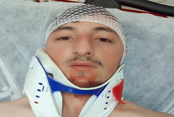 Kayseri'de esnaf kavgas: 1 yaral