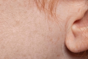 Kış cilt bakımının püf noktaları