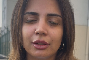 Gözüne yapıştırıcı kaçtı