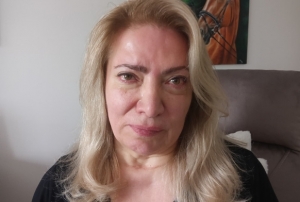 G�zellik merkezinde estetik operasyonu y�z felci yapt�