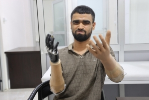 Bacağına ve 2 biyonik koluna kavuştu