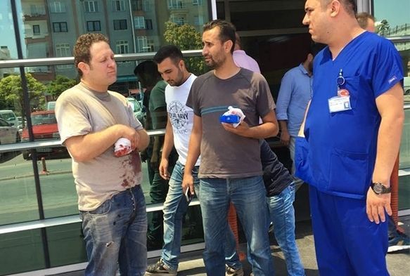 İş kazasında parmağını kaybetti